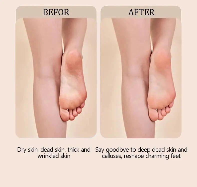 Electric foot trimmer is used to remove dead skin repair feet and remove calluses on the feet 2 grinding heads Now and Later