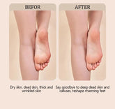 Electric foot trimmer is used to remove dead skin repair feet and remove calluses on the feet 2 grinding heads Now and Later