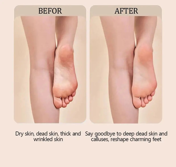 Electric foot trimmer is used to remove dead skin repair feet and remove calluses on the feet 2 grinding heads Now and Later